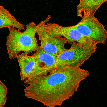PRKAA1 Antibody