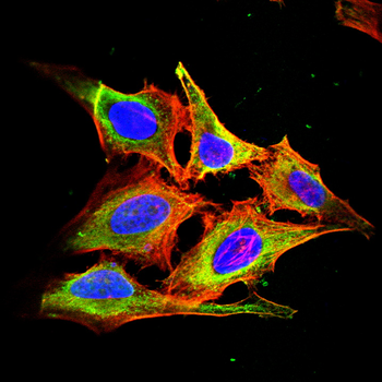 ITGB3 Antibody