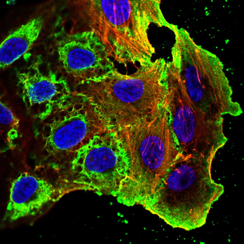 HLA-DR Antibody