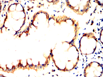HLA-DR Antibody