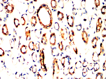 HLA-DR Antibody