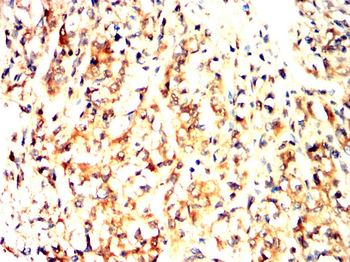 HLA-DR Antibody