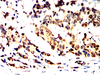 ARRB1 Antibody