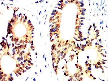 ARRB1 Antibody