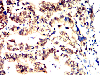 ARRB1 Antibody