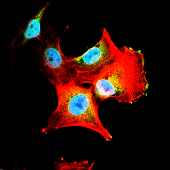 TBXT Antibody