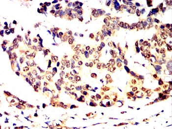 TBXT Antibody