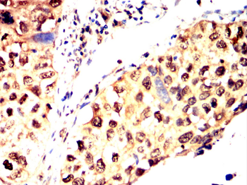 TBXT Antibody