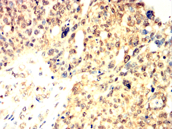 TBXT Antibody