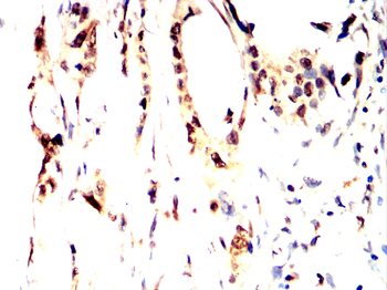 TBXT Antibody