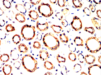 KRT15 Antibody