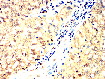 KRT15 Antibody