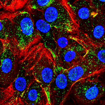 PFKFB3 Antibody