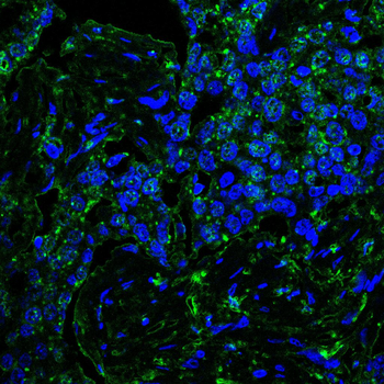 PFKFB3 Antibody