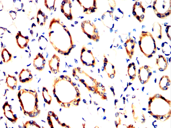PFKFB3 Antibody