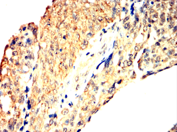 PFKFB3 Antibody