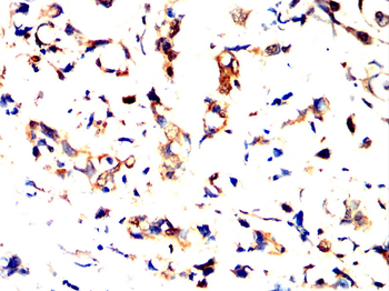 ARHGEF2 Antibody