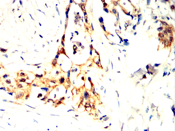 ARHGEF2 Antibody