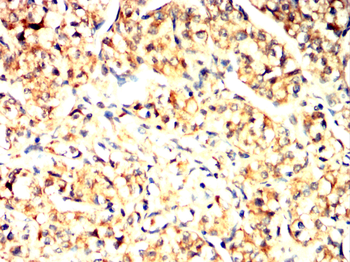 ARHGEF2 Antibody