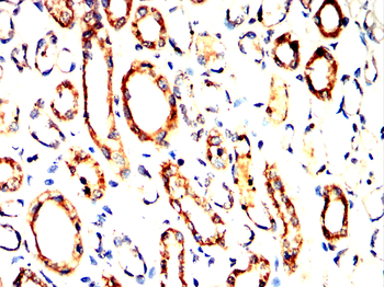 ARHGEF2 Antibody