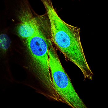 UBA1 Antibody