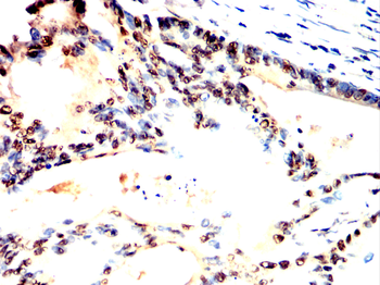 UBA1 Antibody