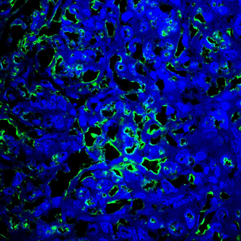 UBA1 Antibody
