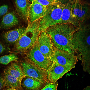 BNIP3 Antibody