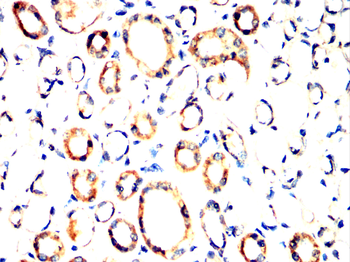 PLIN2 Antibody