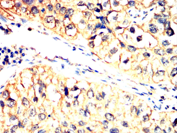 PLIN2 Antibody