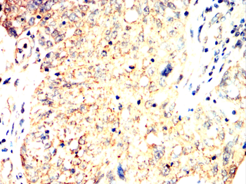 PLIN2 Antibody
