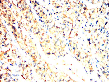 PLIN2 Antibody