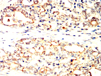PLIN2 Antibody