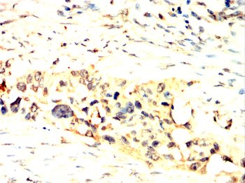 UBD Antibody