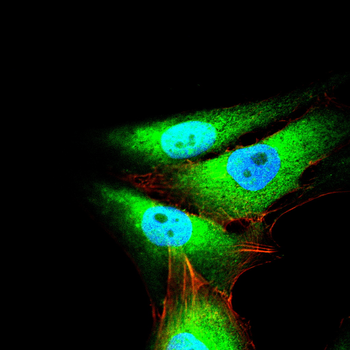 TFF1 Antibody