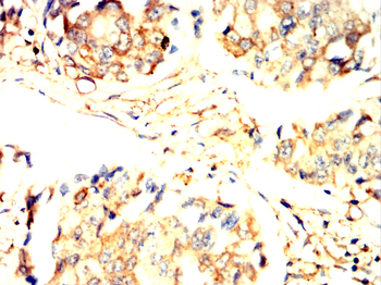 TFF1 Antibody