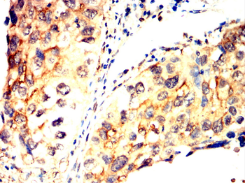 TFF1 Antibody