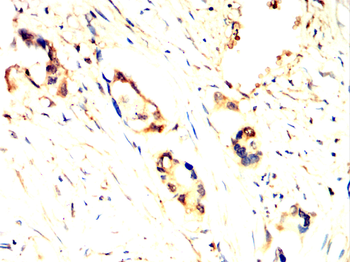 TFF1 Antibody