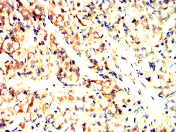 TFF1 Antibody