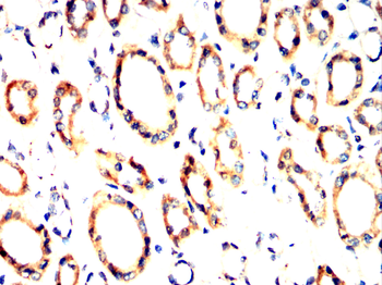 KRT16 Antibody