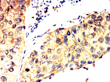 KRT16 Antibody