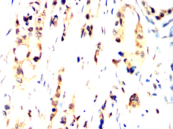 KRT16 Antibody