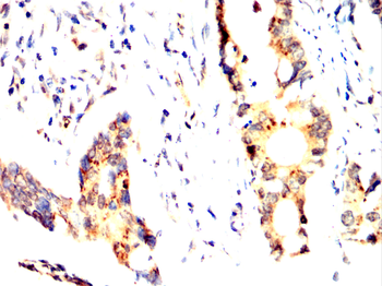 KRT16 Antibody