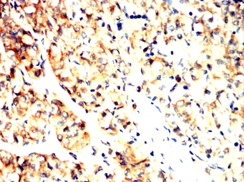 KRT16 Antibody