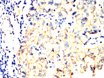 KRT16 Antibody