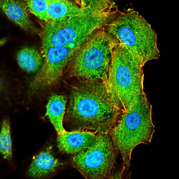 CD1A Antibody