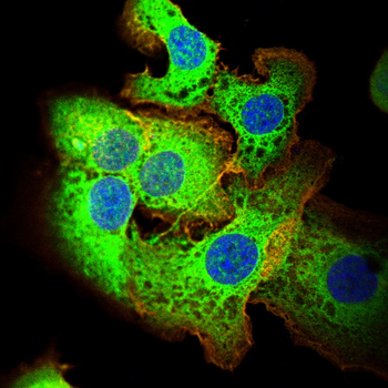 SPHK1 Antibody