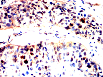 SPHK1 Antibody