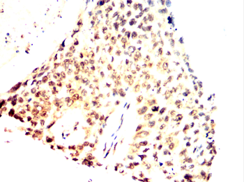 SPHK1 Antibody