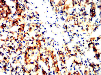 SPHK1 Antibody